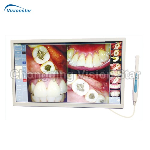 SJD-I960 Intraoral Camera